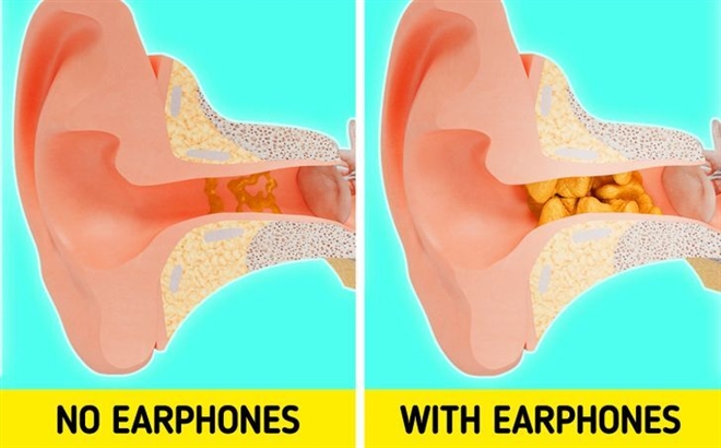 Điều gì sẽ xảy ra nếu đeo tai nghe quá lâu? - 3